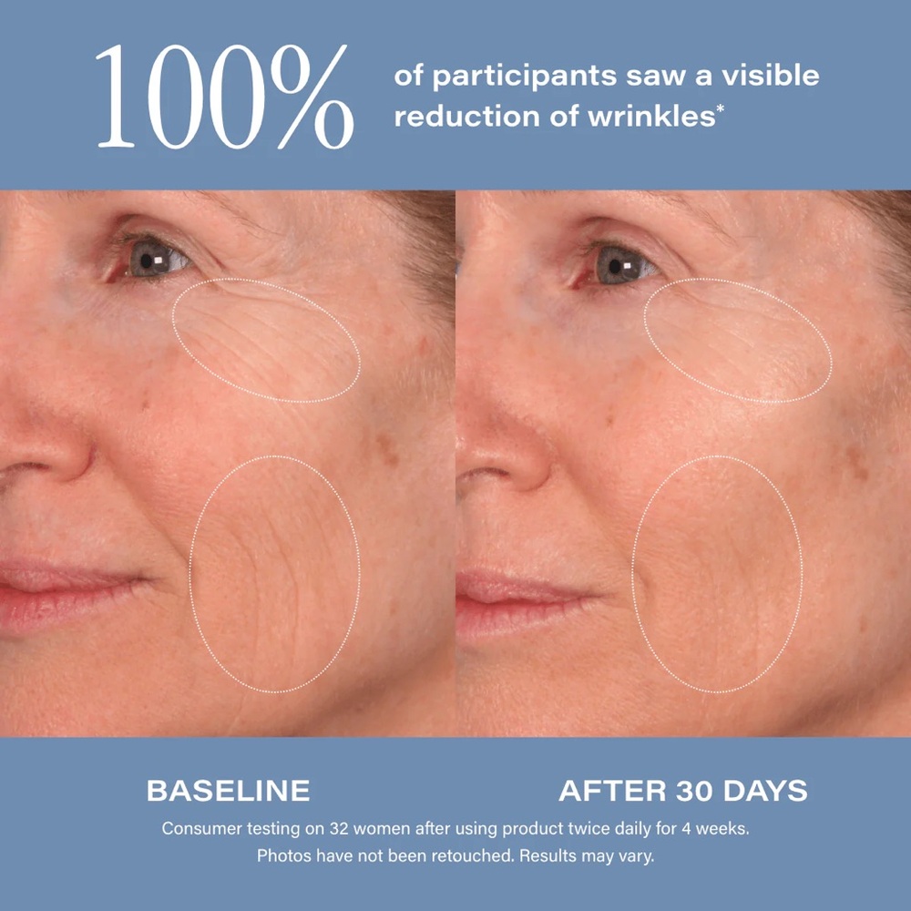 SKINN Cosmetics Deep Age Reset Serum Intensive - Picture 5 of 9